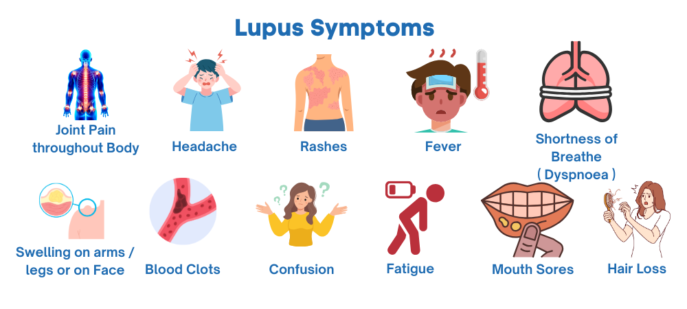 lupus symptoms