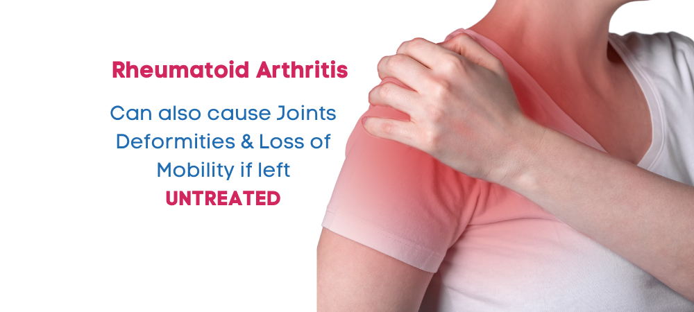 arthritis untreated